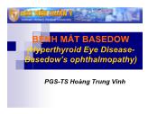Bệnh mắt basedow (hyperthyroid eye diseasebasedow’s ophthalmopathy)